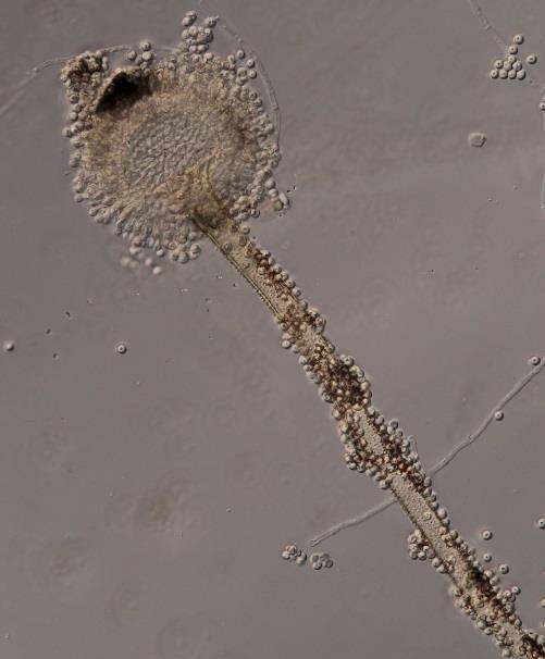 8: Aspergillus ochraceus - líc kolonie na CYA Morfologie a fyziologie Aspergillus westerdijkiae Frisvad & Samson Kolonie na CYA při