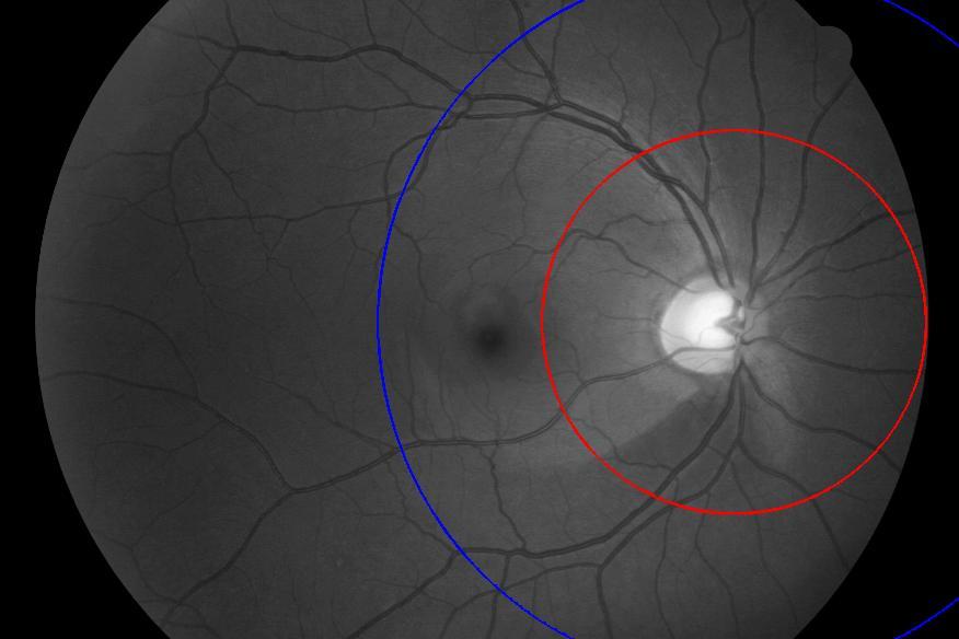 4. Odhad modelu popisujícího fyziologické rozložení VNV na sítnici Nejprve byl v programovém prostředí Matlab vytvoření odhad modelu, který popisuje fyziologické rozložení vrstvy nervových vláken na