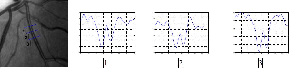 (a) (b) (c) Obrázek 6.