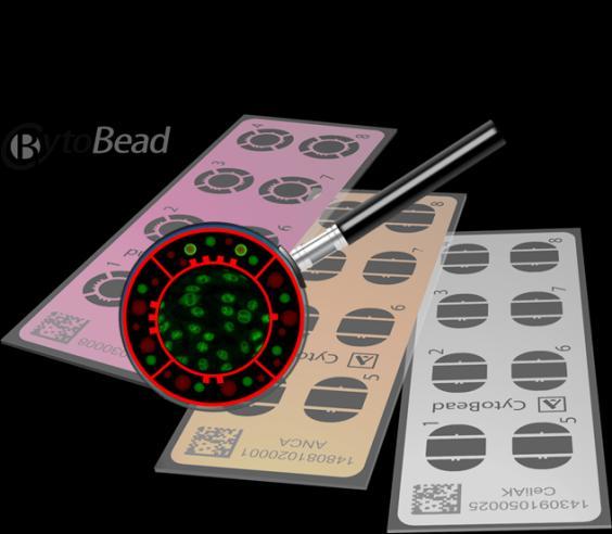 Antigenní substráty používané při nepřímé IF HEp2 (Human Epithelial) - jádro (ANA), cytoplazma (AMA, cytoskelet.