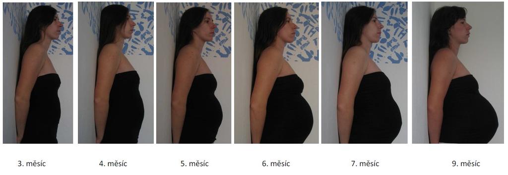 1.2.3.2 Břišní svaly Při zvětšování objemu břišní dutiny dochází k uvolňování a oslabování břišních svalů.