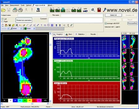 Obrázek 18: Základní výstupní obrázek při měření 3.5 Způsob zpracování a vyhodnocování výzkumných dat Existuje více moţností vizualizace plantárního tlaku.
