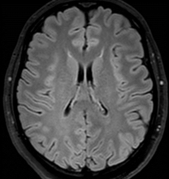 Br J Radiol 2014;87(1035):20130360. Patzig M et al.