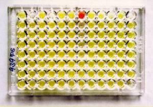 Mikrodiluční test Atb je v řadě důlků v plastové destičce, koncentrace postupně klesá Nejnižší koncentrace, která inhibuje růst,