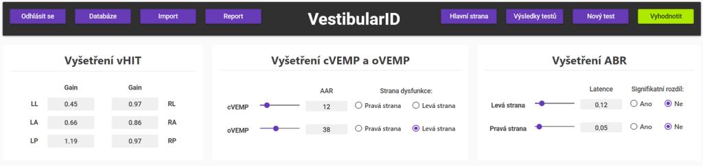 Návrh a realizace SW VestibularID - 47 - Překročení tohoto limitu naznačuje sníženou funkci vejčitého váčku (utriculus) a jeho inervace.