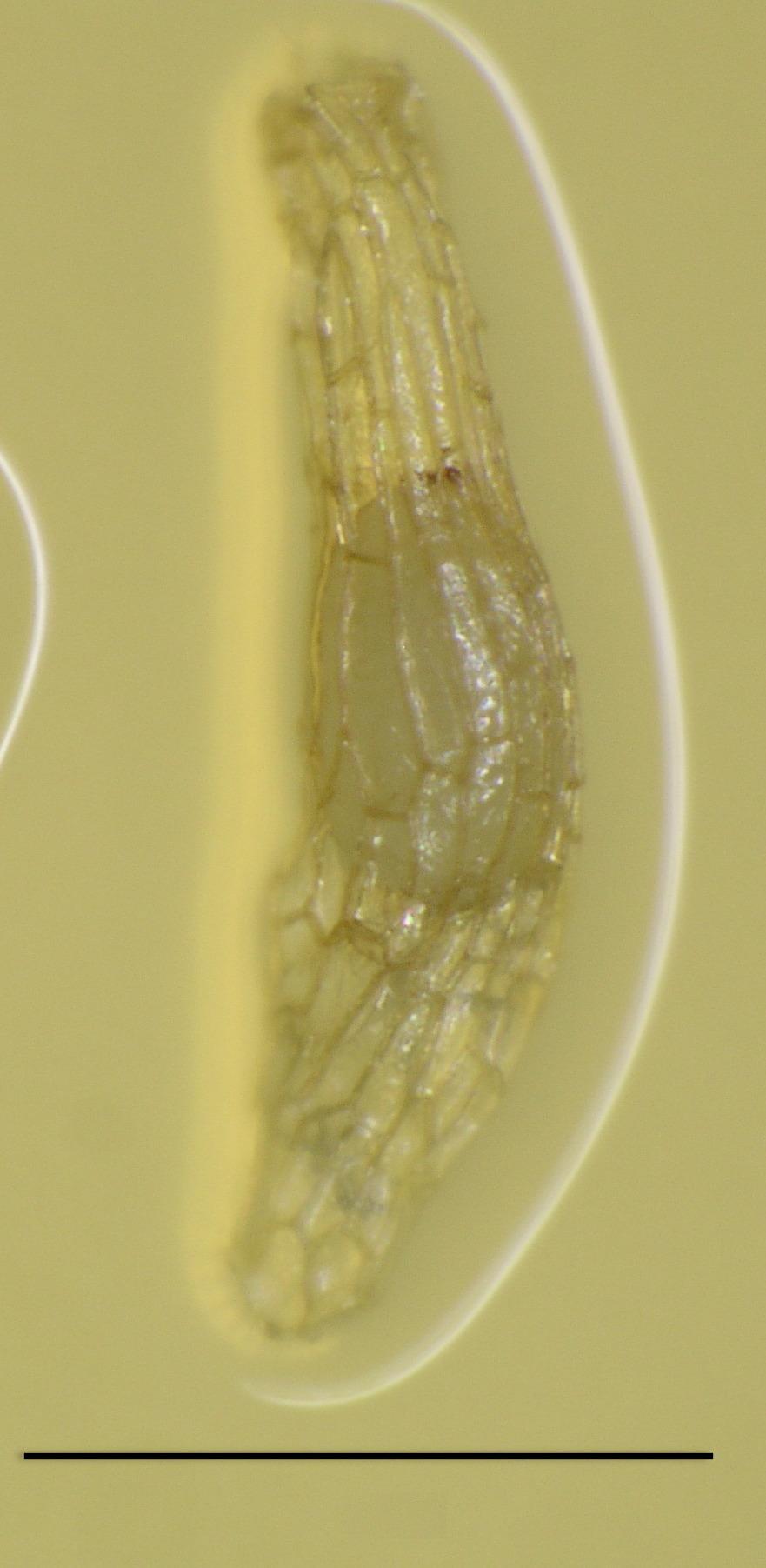 Obr. 3. Obr. 4. Obr. 4.: semeno Anacamptis morio, 3 týdny kultivace; zv.