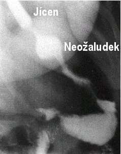 Obrázek 8 RTG pasáž