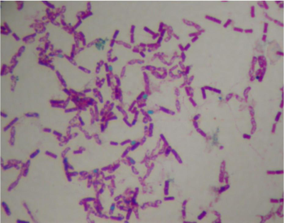 BARVENÍ SPOR [10] Clostridium