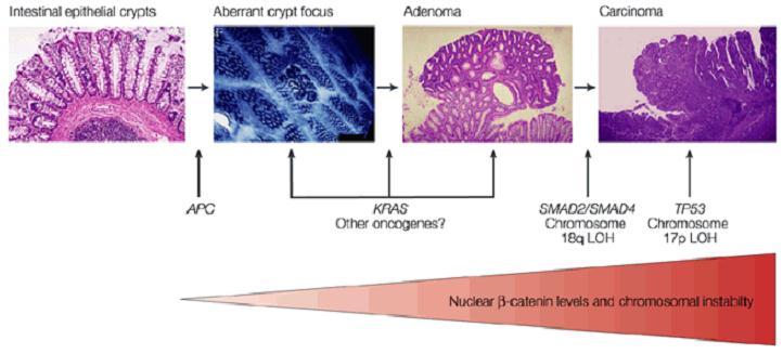 Genetický model kancerogeneze CRC Rostoucí