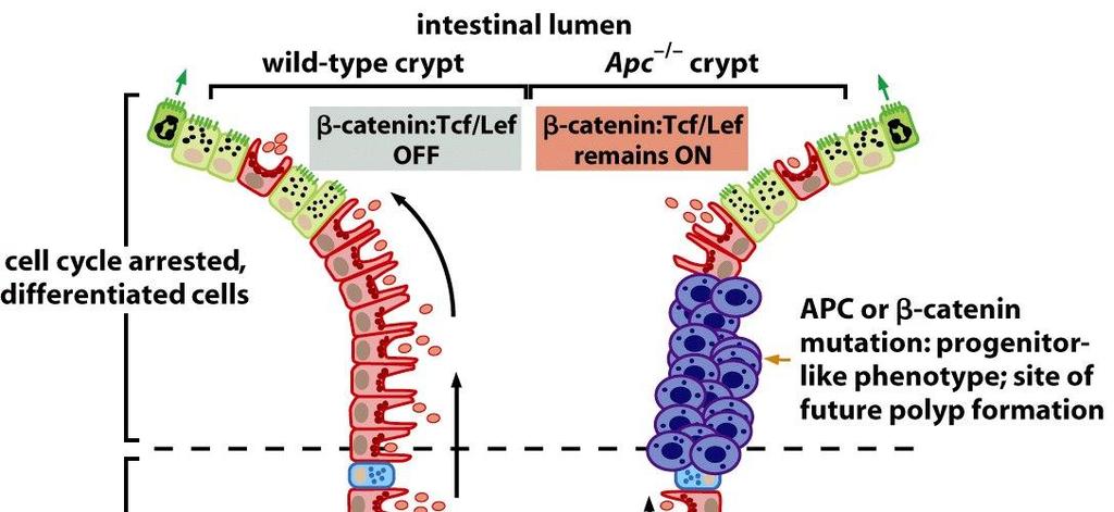 β-katenin a biologie střevních krypt V případě mutace APC jsou vysoké hladiny β-kateninu i bez signálu Wnt, nediferencované proliferující buňky putují