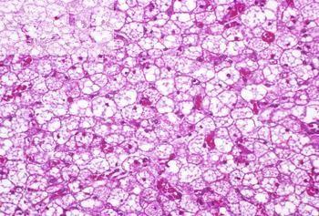 acid) NE norepinefrin (noradrenalin -