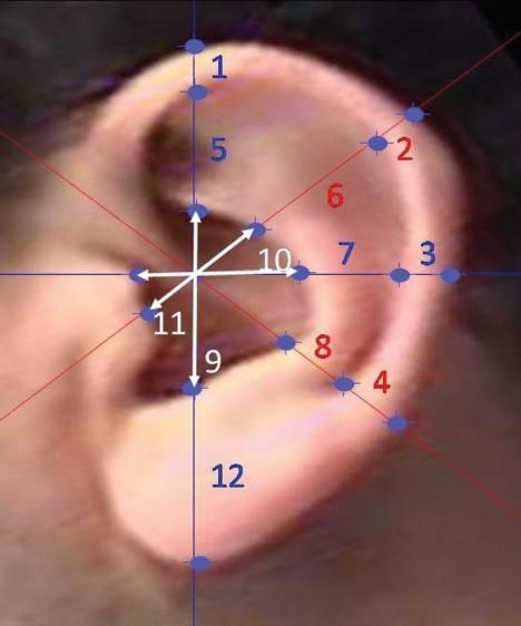 Obrázek č. 3-8 Znaky ušního boltce [25] Nevýhodou je, že může být výkonnost systému omezena přítomností vlasů či doplňků např. v podobě náušnic.