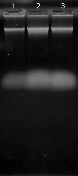 6.2 Izolace DNA metodou fenolové extrakce a její separace pomocí magnetických částic DNA, která byla izolovaná metodou fenolové extrakce z 500 μl hrubých lyzátů buněk jednotlivých bakteriálních kmenů