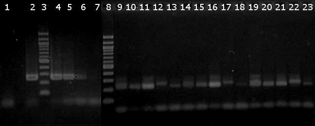 6.9.3 Agarózová gelová elektroforéza produktů real-time qpcr pro rod Lactobacillus Byla provedena detekce produktů real-time qpcr rodu Lactobacillus na agarózovém gelu, výsledek je zobrazen na Obr.