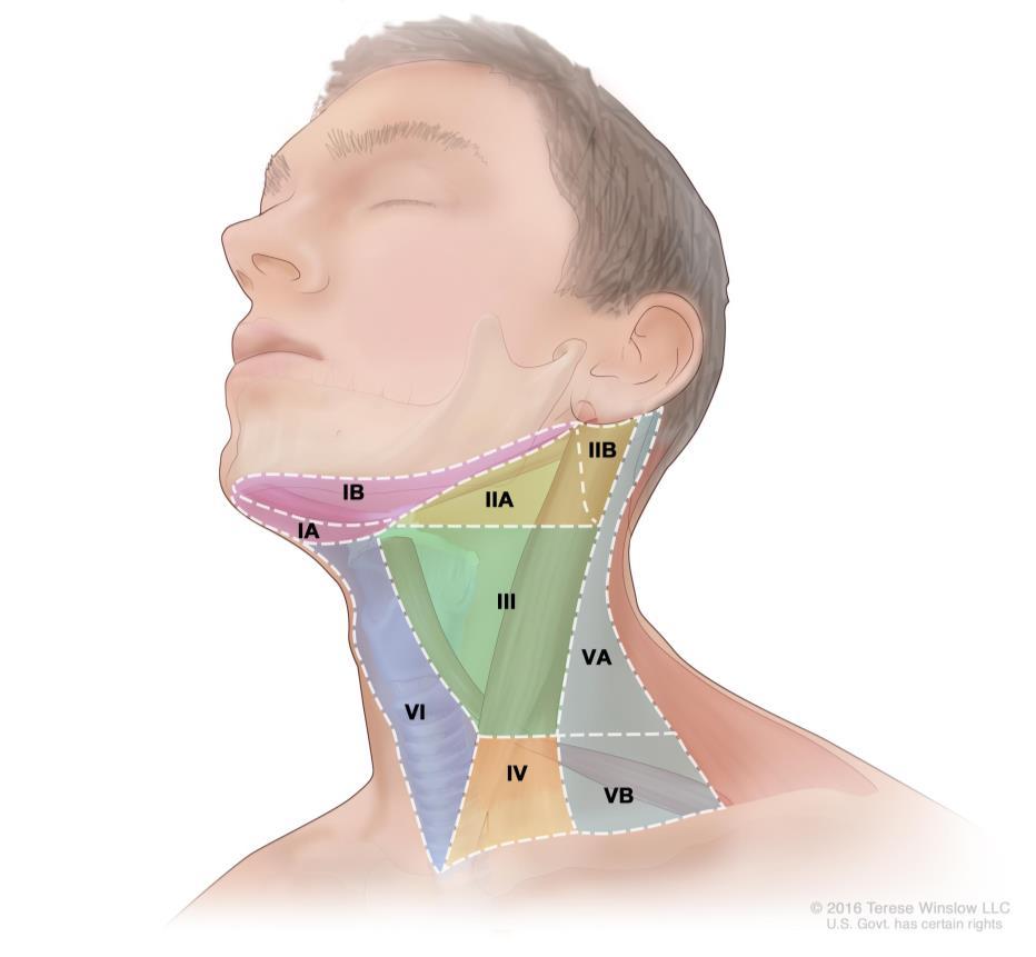 Obrázek 2. Rozdělení krčních lymfatických uzlin do oblastí (zdroj: https://www.cancer.