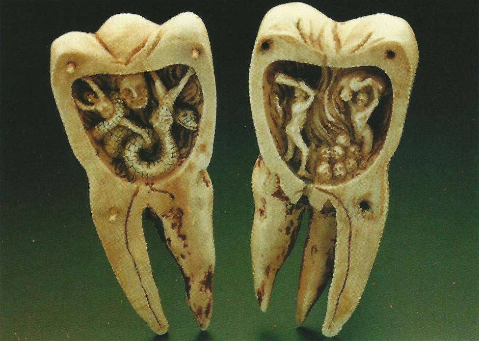 6 Vyobrazení zubních červů. Obr. č. 6 Vyobrazení zubních červů. Zdroj: SCHOTT, Heinz.