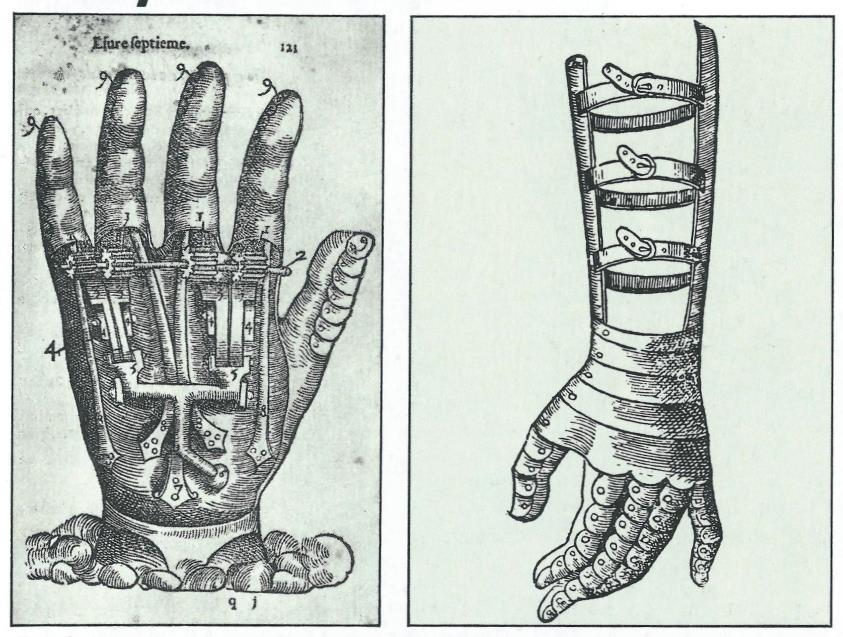 12 Protézy ruky. Obr. č. 12 Protézy ruky. Zdroj: SCHOTT, Heinz. Kronika medicíny. 1. vyd.