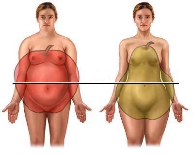2.2.1. Druhy obezity Podle toho, kde se tuk preferenčně ukládá je možné obezitu rozdělit na dva typy.