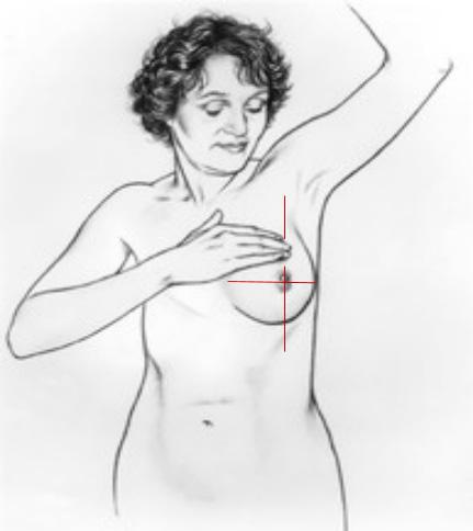 Preventivní mamografie se však provádí jednou za dva roky a některé typy nádorů mohou být v okamžiku vyšetření pod možností zobrazovacích metod.