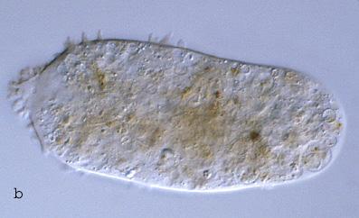 Ciliata Protozoa Rhizopoda - velké druhy schopné přijímat jako potravu celé buňky řas a sinic - rozmanité způsoby