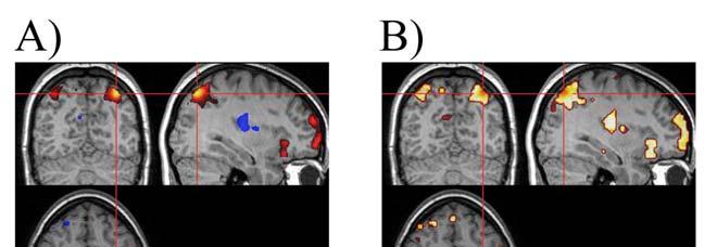 Zkoumání vlivu nepřesností v experimentální stimulaci u fmri Obr. 4.27 Příklad uplatnění kritérií maximální přípustné nepřesnosti pro event-related experiment.