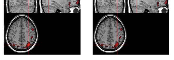 Využití zjištěných skutečností pro optimalizaci experimentů V předchozích kapitolách bylo pomocí simulací ukázáno a konfrontací s reálnými daty ověřeno několik stěžejních poznatků o vlivu nepřesnosti