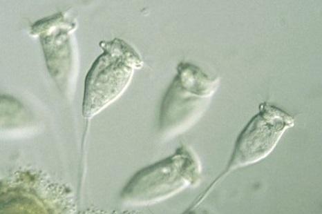 Beggiatoa, Leptomitus, Leucothrix, Microthrix parvicella, Nocardia, Sphaerotilus, Thiothrix převaha vláknitých