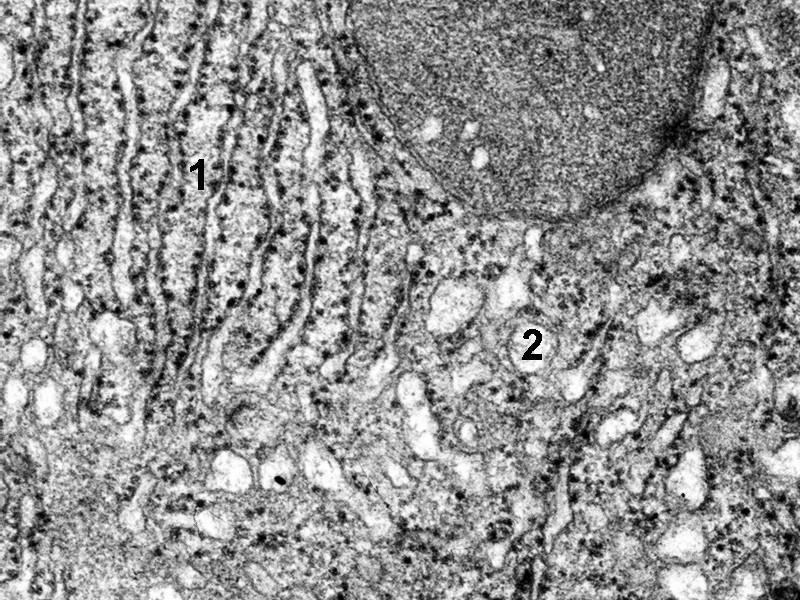 jp g Ribozomy vázané na granulární endoplazmatické