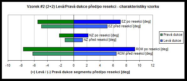 Graf 4. Soubor grafů (Hodnocení tuhosti soustavy - pravá/levá dukce před resekcí/po resekci).