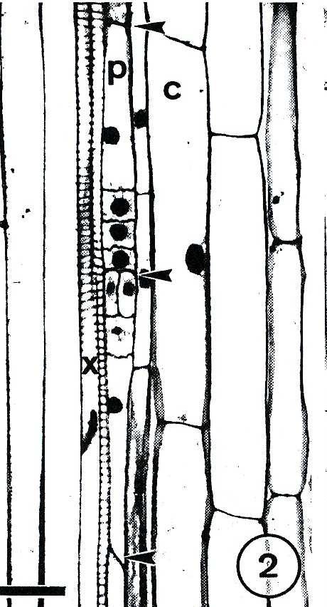obrázek 4 Podélný řez adventivním mateřským kořenem Allium cepa. Zde je vidět první periklinální dělení jedné z krátkých buněk vzniklých asymetrickým antiklinálním dělením.