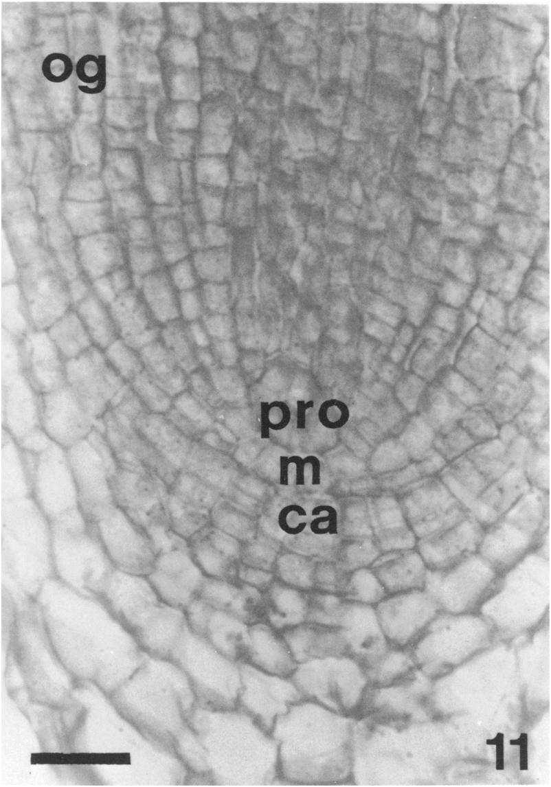 obrázek 5 Apikální meristém postranního kořene Typha glauca s viditelnými třemi meristematickými vrstvami na jejichž vrcholech se nacházejí iniciály.