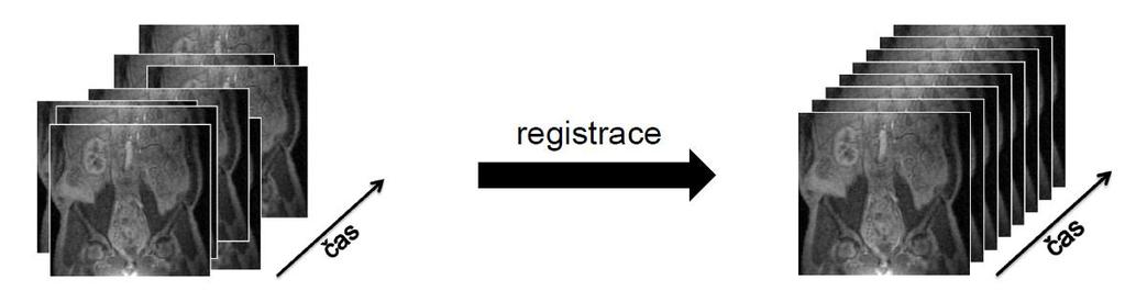 Vlivem různých pohybových artefaktů (dech, pohyb pacienta, artefakty dány zobrazovací metodou a polohou vyšetřované tkáně) je mnohdy nutné provést lícování (registraci) dynamické sekvence v ROI, jak