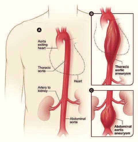 Angiografie