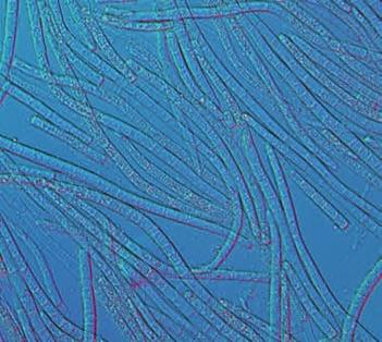 U smrku ztepilého (Picea abies) se vyskytují sypavky jako Lophodermium piceae a Lirula macrospora, ale řeší se pouze okrajově, protože jejich výskyt je v porostech ojedinělý a nepůsobí závažné škody.