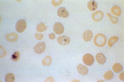 Druhy barvení Supravitální - barvíme živé buňky vybrané z těla (kousky tkáně) propustnost membrán je větší u