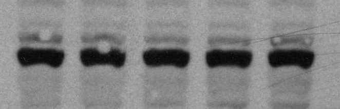 90 80 70 1 μm doxorubicin 5 μm doxorubicin 10 μm doxorubicin 25 μm doxorubicin násobek kontrol 60 50 40 30 50 μm doxorubicin 100 μm doxorubicin 500 μm doxorubicin 1000 μm doxorubicin 20 10 0 volný