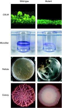 Metody ke studiu biofilmů Konfokální skenovací laserová mikroskopie Mikrotitrační destičky,