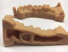 I přestože jsou 3D tiskárny ve stomatologii stále ještě v plenkách, rozvoj je rychlý díky dostupnosti a neustálému vzniku nových příležitostí k jejich využití.