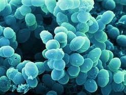 Rod Staphylococcus G+ nepohyblivé koky, fakultativně anaerobní rezistence k
