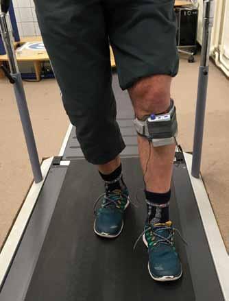 Obr. 1. Funkční peroneální neurostimulátoru přístrojového systému WalkAide. Fig. 1. Functional electrical stimulation of peroneal nerve with WalkAide neurostimulator. u přibližně 8 % pa cientů [2].