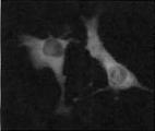 V kontrolních buňkách je fluorescenční signál (GR-GFP) lokalizován především v cytosolu, zatímco jádra neobsahují GR (tmavé skvrny).