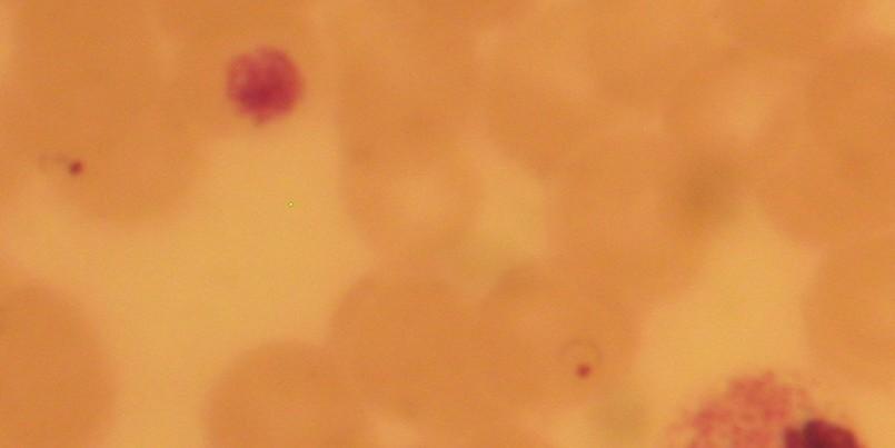 Mikroskopie krevních parazitů příklad výsledku Preparát je barvený Giemsou, objektiv 100 zvětšující.