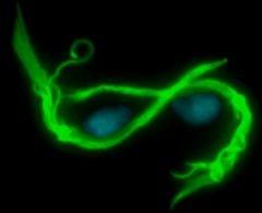 Trichomonas fluorescence http://www.ncl.ac.