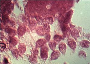 Giardia intestinalis (Lamblie) (trofozoiti) Obrázek převzat z CD- ROM
