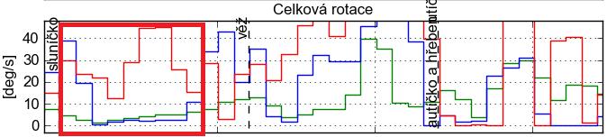 sluníčka u devítiletého chlapce s typickým vývojem, obrázek 5 u šestiletého chlapce s typickým vývojem a obrázek 6 ukazuje pohybovou aktivitu osmiletého autistického chlapce.