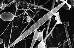 Amnestic shellfish poisons (ASP)