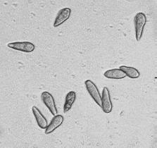 A) Konidie V. inaequalis B) Klíčící konidie V. inaequalis Obr.
