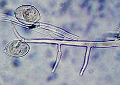 životní cyklus Phytophthora infestans http://www.botany.hawaii.edu/faculty/wong/bot201/ Oomycota/Oomycota.