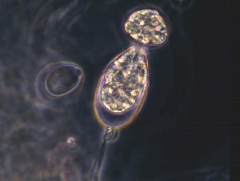 html sporangiofor se sporangii Phytophthora infestans - plíseň bramborová napadá nadzemní části (listy) i