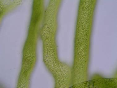 oogonium sifonální vlákna s drobnými chloroplasty Výskyt: